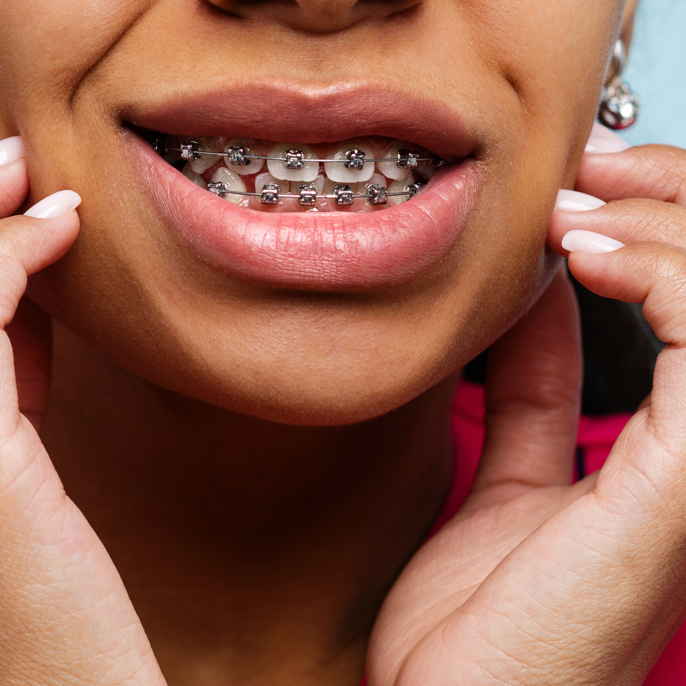 Orthodontic Emergencies